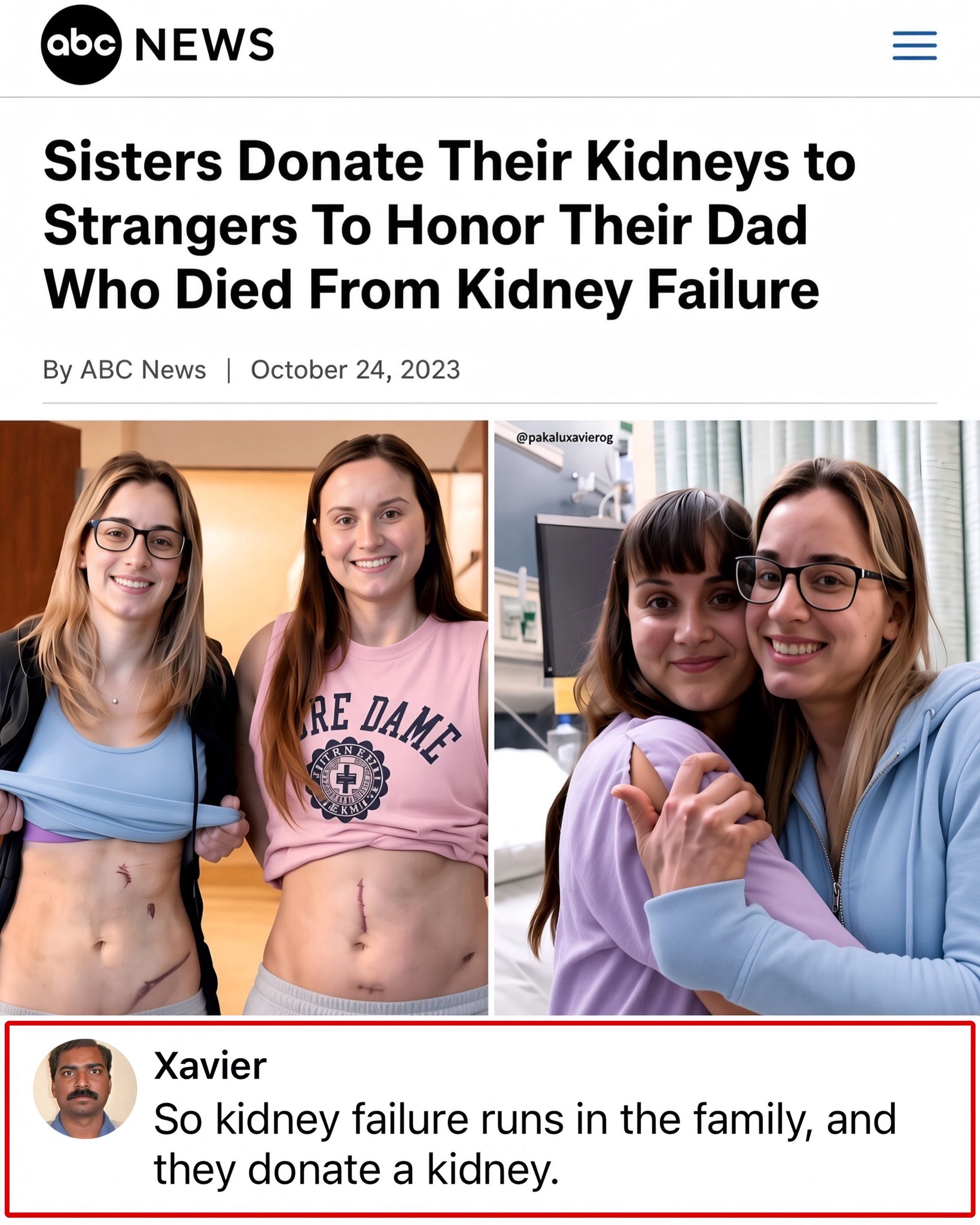 Living altruistic organ donors are hurting themselves.
