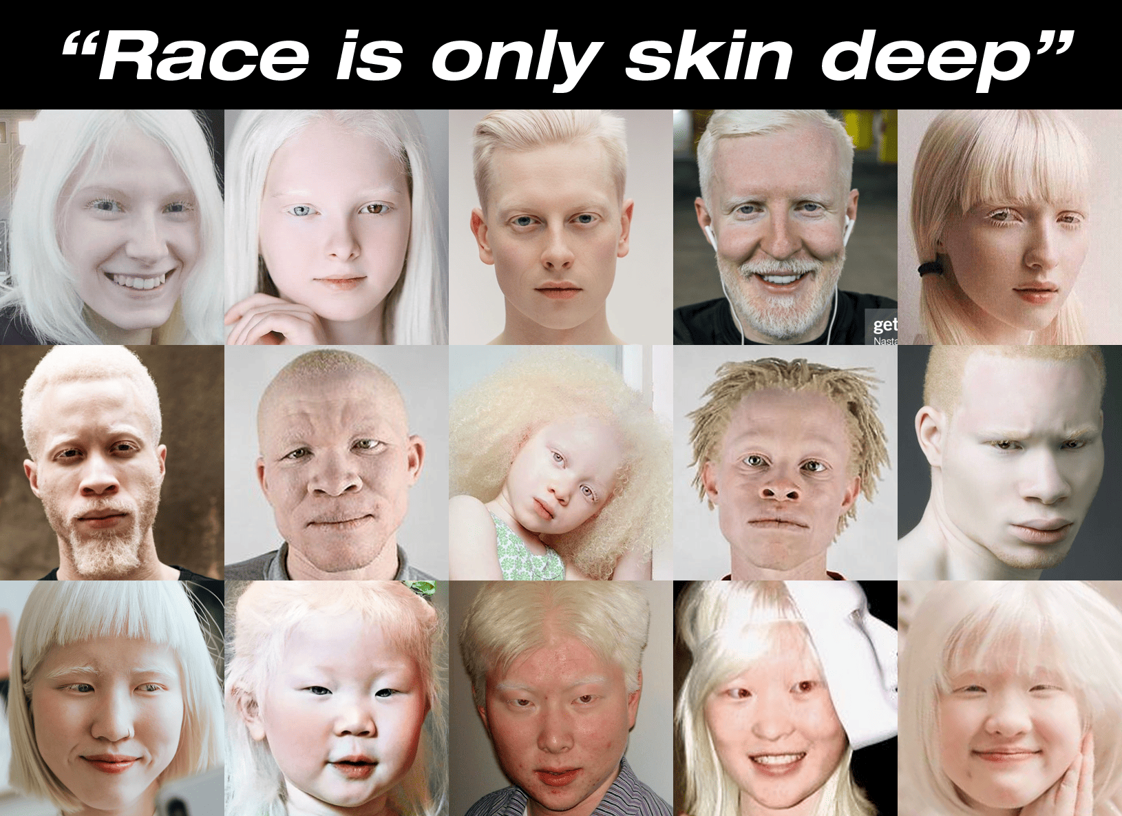 Albino people all have the same skin color, and yet it's still easy to determine which race an albino person belongs to.