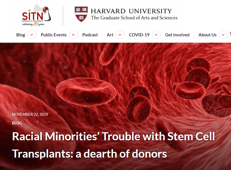 Harvard University says that race matters in organ transplants.