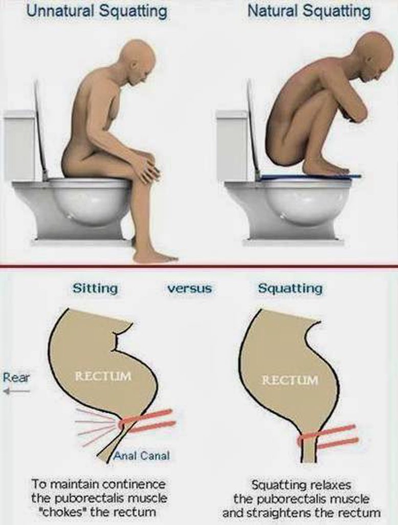 Squatting Vs Sitting On A Toilet